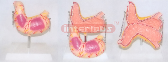 BIG STOMACH ANATOMICAL & ENLARGED MODEL